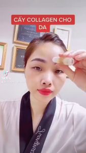 Combo cấy căng bóng Peptide cho da nám lão hóa - SKINJECTION PRO PENTIDE - 2 ống cấy + 2 nạ iLLON sử dụng 1-2 tuần/lần
