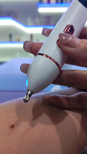 มีสินค้า ปากกากำจัดไฝไฟฟ้า เครื่องมือความงามกำจัดฝ้า เครื่องมือความงามเลเซอร์กำจัดฝ้า ปากกากำจัดไฝอัจฉริยะ 9 สปีด