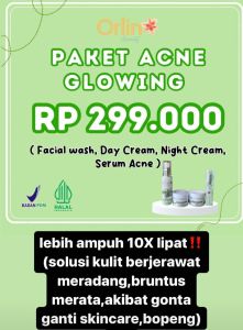 Orlin Beauty Paket Jerawat Krim Bpom ORI Paket Acne Glowing Mencerahkan wajah
