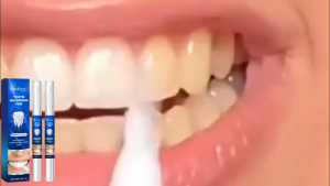Oralhoe Teeth Whitening Pen 6ml - Stain Cleaning Fresh Breath Tooth Brightening Pen Gentle Oral Care Whitening Serum Pen