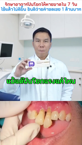 COD ยาสีฟันสมุน ยาสีฟันไวท์เทนนิ่ง ยาสีฟันเบกกิ้งโซดา ยาสีฟันสมุนไพร ดูแลสุขภาพเหงือก100G ลดกลิ่นปาก ลดอาการเสียวฟัน ยาสีฟันดูแลล้ำลึกทุกปัญหาในช่องปาก