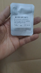 Minivis Chỉnh Nha - Minivis Nha Nha Khoa Niềng Răng