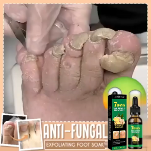 JAYSUING Ginger Nail Care Liquid 30ml with Urea Glycerin and Ginger Root Extract
