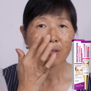 Original Nicotinamide Whitening Freckle Serum Melanon Dark Spot krim jeragat degil berkesan pigmentation 20G Penghantaran Percuma Serum Pemutih Nicotinamide Asli Untuk Jeragat 原始烟酰胺美白雀斑血清黑色素黑斑