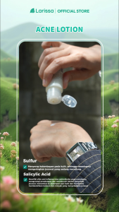 Acne Lotion Larissa / Totol Jerawat Larissa (Obat Jerawat Larissa)