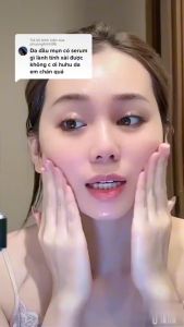 Serum ngừa mụn thâm Acnes Centella Aisatica Ampoule 50ml Kyung Lab siêu kiềm dầu làm dịu giảm sưng viêm mụn thâm thu nhỏ lỗ chân lông
