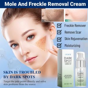 Freckle Removal Cream Moisturizing Brightening Cream Freckle Lightening Cream Rejuvenating Skin Oil Control Shrink Pores
