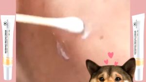 Freckle Removal Essence Mole Removal Freckles Removal Whitening Powerful Removing Age Dark Spots Acne Removing Scar Chloasma Lightening Liquid