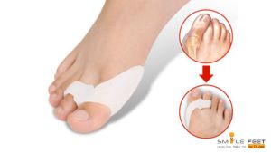 อุปกรณ์ช่วยประคองนิ้วโป้งเท้า Hallux Valgus ซิลิโคนปรับนิ้วโป้งเอียง ปรับนิ้วโป้งเท้า ลดการเสียดสี