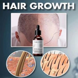 Hair Growth Serum 60ml hair growth prophylaxis hair loss Natural herbal extracts hair oil serum Grow black hair White hair turns black