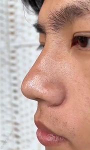 木子言同款后美博士积雪草泡泡面膜深层清洁收缩毛孔去黑头粉刺 Centella Asiatica Bubble Facial Mask祛黑头 黑头棒。。。