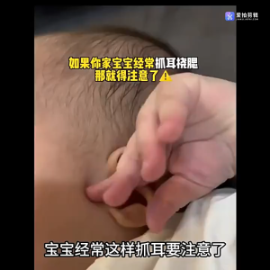 FFEEKK เครื่องดูดขี้หู แหล่งกำเนิดแสง LED ถอดปรับได้ ขยายห้าเท่า มองเห็นได้ชัดเจน ที่แคะขี้หู ที่แคะหูเด็ก ไม้แคะหูมีไฟ ไม้แคะหูเด็ก ที่หนีบขี้หู ที่ดูดขี้หู ที่ดูดขี้หูออก ยาละลายขี้หู ที่คีบขี้หู