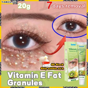 👒𝒔𝒈 𝒔𝒕𝒐𝒄𝒌👒 Milia seed removal cream / Milia removal eye cream / Fat granules remover eye cream / Milia seed remover / 去除脂肪粒 / 眼霜