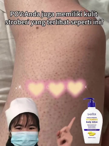 BOOM SADOER Vitamin E Lotion Whitening Collagen Lotion Body lotion pemutih badan permanen hand body pemutih kulit blecing whitening Pulihkan pemutihan kulit memutihkan seluruh tubuh 400ML