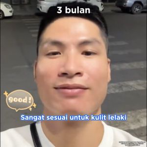RAU SERUM Pudarkan ParutKurangkan Jerawat Lembutkan kulit Untuk Parut Berlubang - Acne Fading Serum Original For Men Dark Spots And Restores Skin Supports Reduction Pitted Scars Soothing 30 ML ORIGINAL READYSTOCK