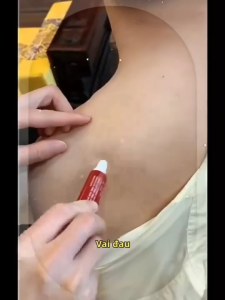 GEL THOÁT VỊ ĐĨA ĐỆM JINGUKANG  sưng tấy và giảm khó chịu