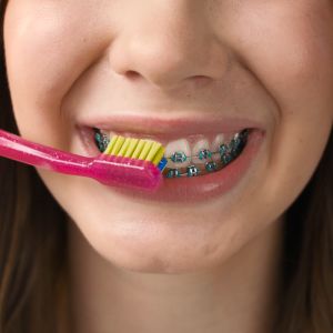 Curaprox Complete Ortho Kit Set for Ortho with toothbrushes interdental brushes and ortho wax