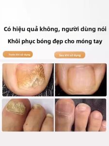 IMLUCKY | Máy cạo móng tay điện tử đa năng IMLUCKY Máy làm nhung mới 2025 Máy làm nhung chân cho người cao tuổi sử dụng tại nhà