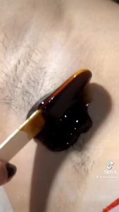 Hunnywax Sugar Wax Kit - 100% natural hot/cold sugar waxing kit & jar (300ml SIZE)