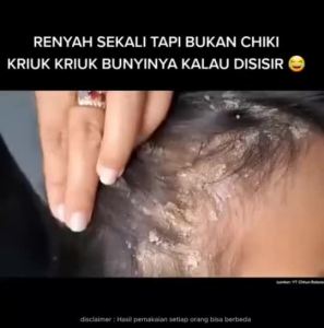 TORRENTIAL SHAMPOO ANTI KETOMBE (FREE GIFT) Shampoo Penghilang Ketombe AURA KASIH APPROVED 250ML / Shampoo Penghilang Jamur dan Gatal / Atasi Rambut Rontok / Torrential Penumbuh Rambut / Shampoo Non SLS ORIGINAL