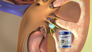 Neysure 1 Gold Special Nutritional Product For Kidney Patients With Increased Blood Urea 400g
