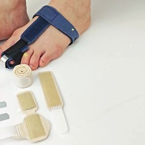 Adjustable Toe Fixation Strap Fixation Splint Detachable Aluminum Plate Support Toe Protector Toe Corrector Bunion Straightener