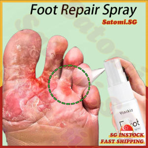 💄SG Stock💄 Foot spray deodorant / Anti fungal foot spray / Athlete foot spray / Foot odor spray / Fungus foot treatment / 腳臭噴霧