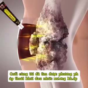(10 cái) Kem bôi xương khớp giảm đau lưng đau cơ căng cơ bong gân giảm sưng tê mỏi