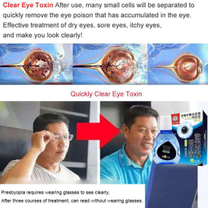Eye Problems Therapy Eye Drops for Myopia and Astigmatism Improvement Eye Supplement Lutein 10ml 近视明目滴眼液