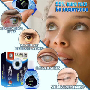 [100% Asli ] Obat tetes mata Tetes Mata Herbal Mata Alami eye drop Astigmatisme Miopia Presbiopia Katarak Glaukoma Floaters