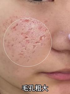 Baiyunshan | Salicylic Acid Pore Tightening Facial Essence Liquid