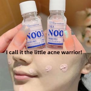 Vsea Double Acid Clear Skin Small Pink Water Acne Scar Fading Pore Shrinking Blackhead Removal Liquid Essence for Acne Prone Skin