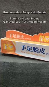Salep Kulit Telapak Kaki & Tangan Pecah Pecah: Peeling Skin Cream