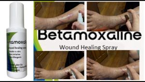 Betamoxaline Wound Healing Duo