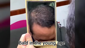Dexe Hair Building Fibers Prevents Hair Loss Scalp Covering Powder