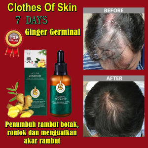 ZENSHOW Hair Care: Mengurangi Rambut Rontok & Meningkatkan Pertumbuhan Rambut