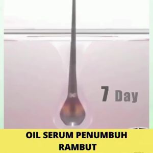 Pertumbuhan rambut penumbuh rambut cepat Ginger King Serum Anti Botak obat penumbuh rambut Penumbuh Rambut Secara Cepat Penyubur Rambut Rontok Pria
