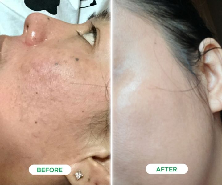 10X WHITENING BLEACHING CREAM Greenika Face Bleaching Cream Niacinamide Lightens Skin Pigmentations Scars and Blemishes Erases Sun Spots Dark Spots and Acne Scars Whitening Cream for Dark Spot