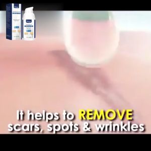 EELHOE เจลลดรอยแผลเป็น รอยแผลเป็นจากการตั้งครรภ์ รอยแผลเป็นจากการผ่าตัด เจลบำรุงผิวให้ความชุ่มชื้นและฟื้นฟูผิว