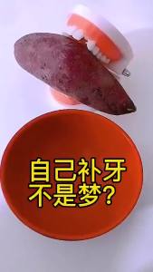 Bộ Dụng Cụ Sửa Chữa Răng Tạm Thời 10g-30g Răng & Khe Hở Keo Dán Chắc Chắn Chất Kết Dính Răng Giả Làm Trắng Răng Dụng Cụ Làm Đẹp Răng Để Chăm Sóc Răng Miệng Tức Thì