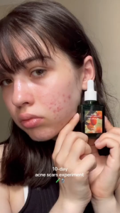 Dr.Althea Vitamin C Boosting Serum RENEWED Dark Spot Care | Uneven Skin Tone | Daily Facial Serum
