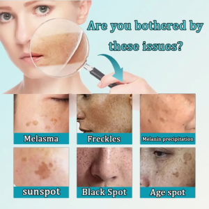 Dark Spot Serum/ Brightening Serum/ Removal Melasma Cream 20ml/ Dark Spot/ Remover Anti Aging Whitening Cream Contains Nicotinamide/ 美白祛斑