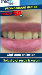 Gigi palsu SNAP ON SMILE SATU SET ATAS BAWAH 100 % Original Bisa COD
