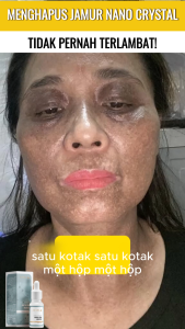 [Combo Hemat] BELI 2 ABERA MELASMA SERUM (20ml) - Efektif Memudarkan Flek Hitam & Bintik Penuaan