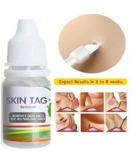 Stretch Mark Repair Cream Powerful Postpartum Obesity Stretch Marks Scar Remover Pregnancy Precious