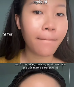 Bộ 3 Hoàn Hảo Dưỡng Trắng Phục Hồi Trẻ Hóa Thu Nhỏ Lỗ Chân Lông Deepondé Glutathione: Nước Thần + Serum + Kem Dưỡng Deeponde