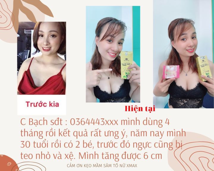 %5B%20Cam%20K%E1%BA%BFt%20Ch%C3%ADnh%20H%C3%A3ng%20%5D%20M%E1%BA%ABu%20M%E1%BB%9Bi%20Nh%E1%BA%A5t%20Li%E1%BB%87u%20Tr%C3%ACnh%205%20H%E1%BB%99p%20K%E1%BA%B9o%20M%E1%BA%A7m%20S%C3%A2m%20T%E1%BB%91%20N%E1%BB%AF%20Xmax%20%20K%E1%BA%B9o%20M%E1%BA%A7m%20Th%E1%BA%A3o%20M%E1%BB%99c%2037%20T%C4%83ng%20Size%20V%C3%B2ng%201%20%C4%90%E1%BA%B9p%20Da%20T%C4%83ng%20n%E1%BB%99i%20ti%E1%BA%BFt%20t%E1%BB%91%20n%E1%BB%AF%20-%20Image%204