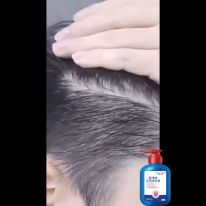 Dầu gội Selenium disulfide dầu gội trị gàu dầu gội trị gàu dầu gội kiểm soát dầu 300ml phục hồi gàu mãn tính chống nấm ngứa dưỡng ẩm chân tóc