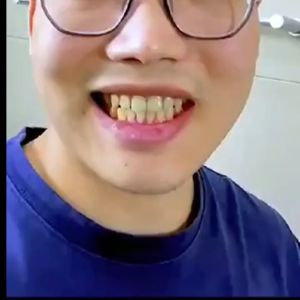 Gaolibai Pasta Gigi: Pemutih Gigi & Penghilang Karang Gigi