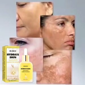 OUHOE เอสเซนส์แก้ไขจุดด่างดำ ช่วยให้จุดด่างดำและริ้วรอยบนใบหน้าแลดูจางลง ให้ความชุ่มชื้น สดใส และขาวขึ้น